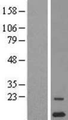 Western Blot: ORF1 FL49 Overexpression Lysate [NBP2-06004]