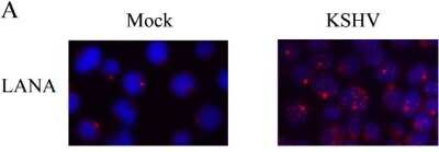 Immunocytochemistry/ Immunofluorescence: ORF73/HHV8 Antibody (4C11) - BSA Free [NBP1-30176]
