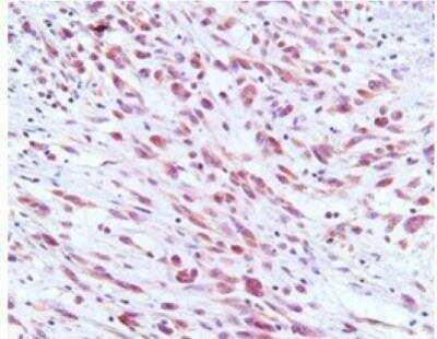 Immunohistochemistry-Paraffin: ORF73/HHV8 Antibody (4C11) - BSA Free [NBP1-30176]