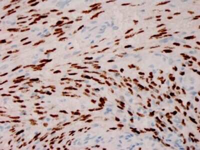 Immunohistochemistry-Paraffin: ORF73/HHV8 Antibody (HHV8/3606) - Azide and BSA Free [NBP3-08645]