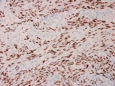 Immunohistochemistry-Paraffin: ORF73/HHV8 Antibody (HHV8/3633R) [NBP3-07279]