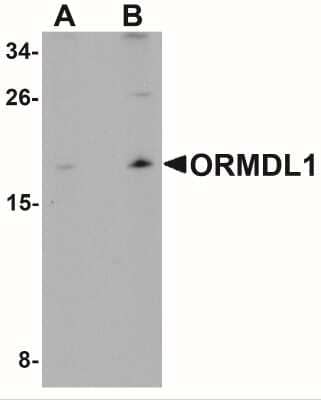 Western Blot: ORMDL1 AntibodyBSA Free [NBP1-76577]