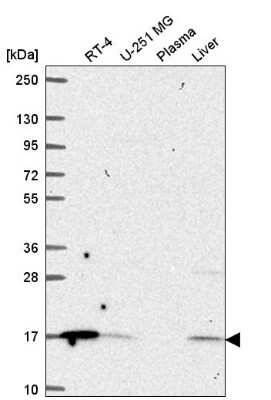 Western Blot: ORMDL1 Antibody [NBP2-56646]