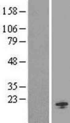 Western Blot: ORMDL1 Overexpression Lysate [NBL1-13979]