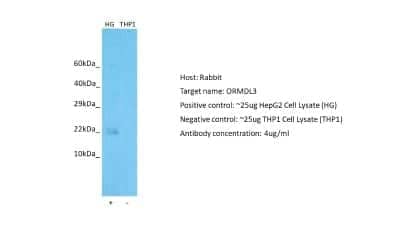 Western Blot: ORMDL3 Antibody [NBP1-98511]