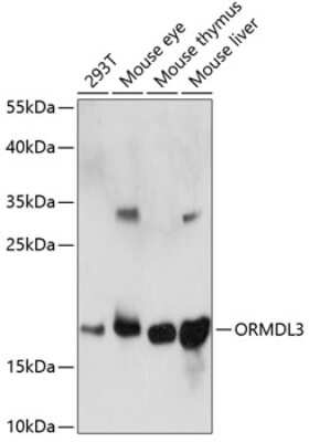 Western Blot: ORMDL3 AntibodyAzide and BSA Free [NBP2-95148]