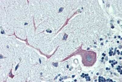 Immunohistochemistry-Paraffin: ORP1 Antibody [NB100-1331]