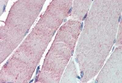 Immunohistochemistry-Paraffin: ORP1 Antibody [NB100-1331]
