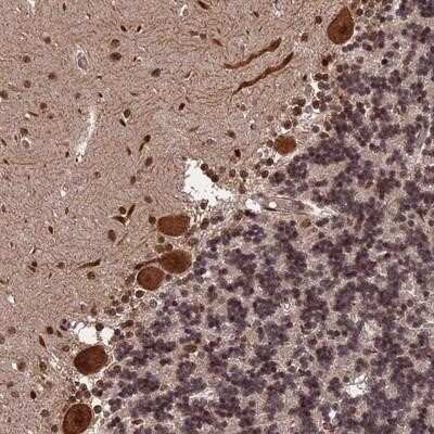 Immunohistochemistry-Paraffin: ORP1 Antibody [NBP1-92233]