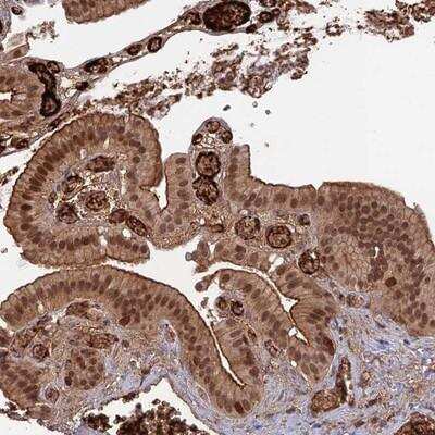 Immunohistochemistry-Paraffin: ORP1 Antibody [NBP1-92234]