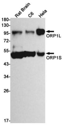 Western Blot: ORP1 Antibody (S02-2E2) [NBP3-19727]