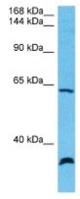 Western Blot: ORP1 Antibody [NBP3-10055]