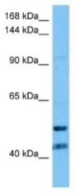 Western Blot: ORP1 Antibody [NBP3-10085]