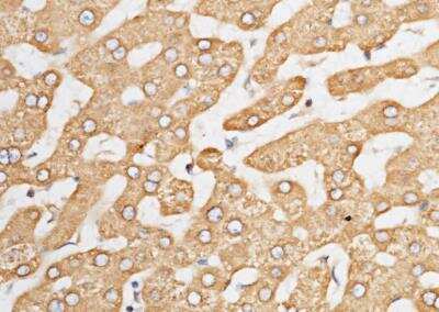 Immunohistochemistry-Paraffin: ORP150/HSP12A Antibody (201) [NBP2-89890]