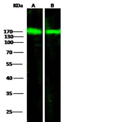 Western Blot: ORP150/HSP12A Antibody (201) [NBP2-89890]