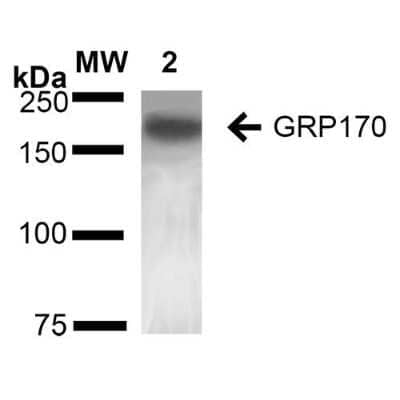 Western Blot: ORP150/HSP12A Antibody (6E3-2C3) [NBP2-59345]