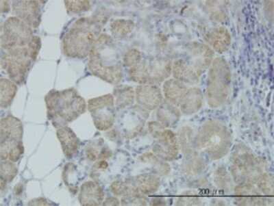 Immunohistochemistry-Paraffin: ORP150/HSP12A Antibody (6F7) [H00010525-M01]
