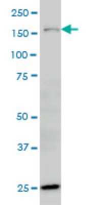 Western Blot: ORP150/HSP12A Antibody (6F7) [H00010525-M01]