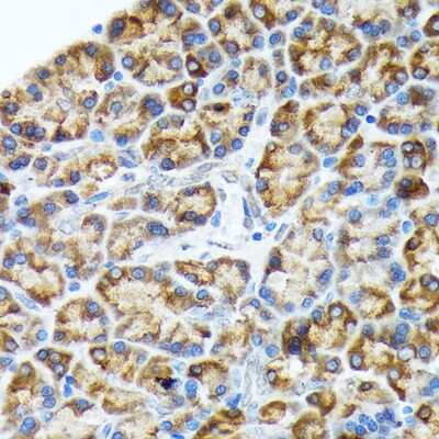Immunohistochemistry-Paraffin: ORP150/HSP12A Antibody (6H7X2) [NBP3-15331]
