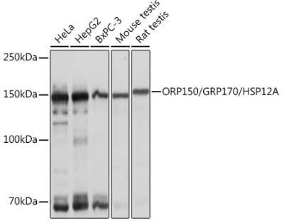 Western Blot: ORP150/HSP12A Antibody (6H7X2) [NBP3-15331]