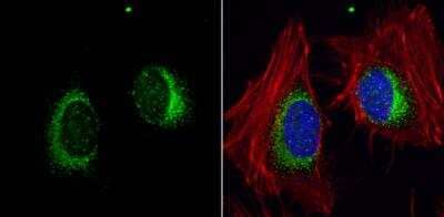 Immunocytochemistry/ Immunofluorescence: ORP150/HSP12A Antibody [NBP1-32140]