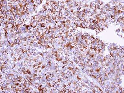Immunohistochemistry-Paraffin: ORP150/HSP12A Antibody [NBP1-32140]