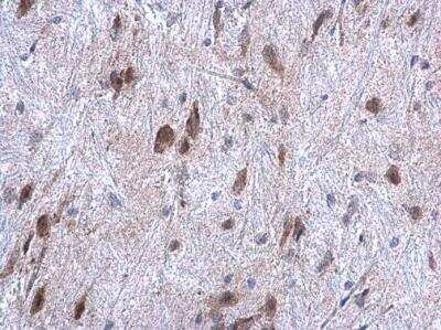 Immunohistochemistry-Paraffin: ORP150/HSP12A Antibody [NBP1-32140]