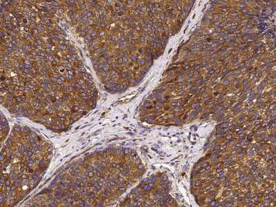 Immunohistochemistry-Paraffin: ORP150/HSP12A Antibody [NBP2-99781]