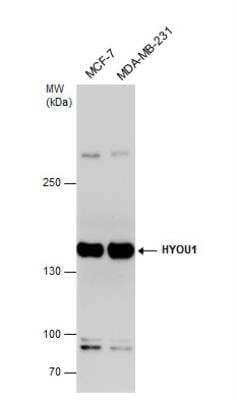 Western Blot: ORP150/HSP12A Antibody [NBP1-32140]