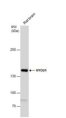 Western Blot: ORP150/HSP12A Antibody [NBP1-32140]