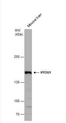 Western Blot: ORP150/HSP12A Antibody [NBP1-32140]