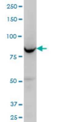 Western Blot: ORP8 Antibody (4H6) [H00114882-M02]