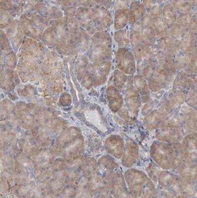 Immunohistochemistry-Paraffin: ORP8 Antibody [NBP1-92235]