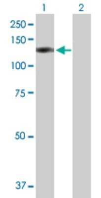 Western Blot: ORP8 Antibody [H00114882-B01P]