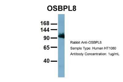 Western Blot: ORP8 Antibody [NBP1-59815]