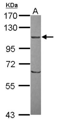 Western Blot: ORP8 Antibody [NBP2-19634]