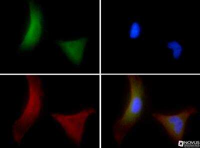 Immunocytochemistry/ Immunofluorescence: OS9 Antibody [BC100-520]