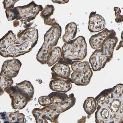 Immunohistochemistry-Paraffin: OS9 Antibody [NBP1-84803]