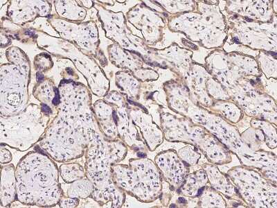 Immunohistochemistry-Paraffin: OS9 Antibody [NBP2-97279]