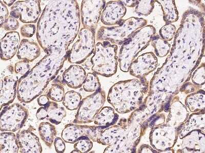 Immunohistochemistry-Paraffin: OS9 Antibody [NBP2-97288]