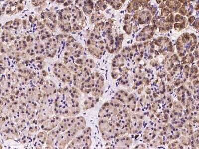 Immunohistochemistry-Paraffin: OS9 Antibody [NBP2-97288]