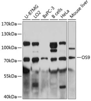 Western Blot: OS9 AntibodyAzide and BSA Free [NBP2-93962]