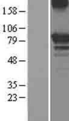 Western Blot: OS9 Overexpression Lysate [NBL1-13982]