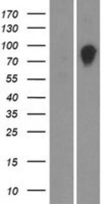 Western Blot: OS9 Overexpression Lysate [NBP2-08681]