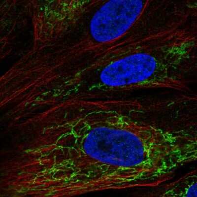 Immunocytochemistry/ Immunofluorescence: OSAP Antibody [NBP2-54955]