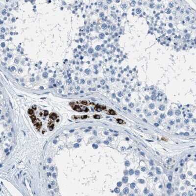 Immunohistochemistry-Paraffin: OSAP Antibody [NBP2-54955]