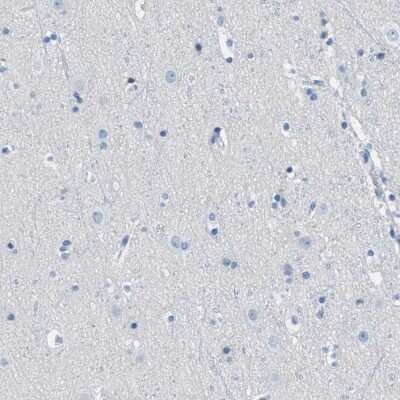 Immunohistochemistry-Paraffin: OSAP Antibody [NBP2-54955]