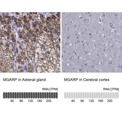 Immunohistochemistry-Paraffin: OSAP Antibody [NBP3-17084]