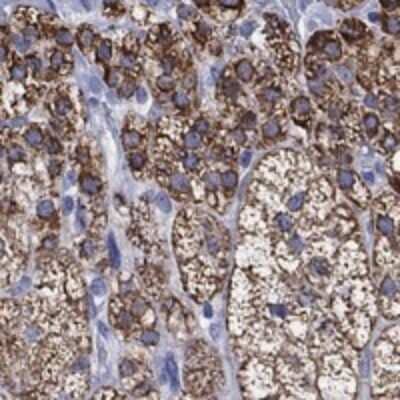 Immunohistochemistry-Paraffin: OSAP Antibody [NBP3-17084]