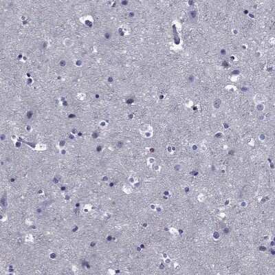 Immunohistochemistry-Paraffin: OSAP Antibody [NBP3-17084]
